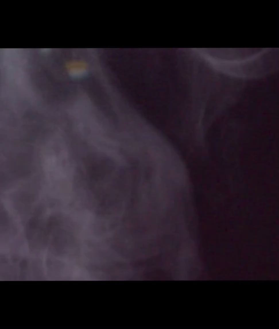 Cargar video: 